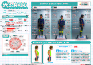 Posture Assessment Software Yugamiru Cloud | posture report jp